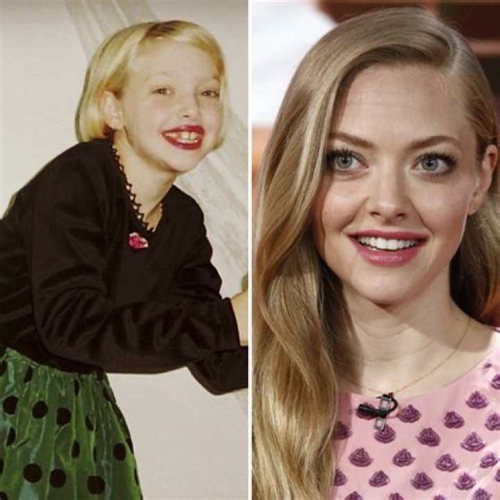 Amanda Seyfried, Victoria Beckham and 5 Other Stars Who Didn’t Always Have a Perfect Smile
