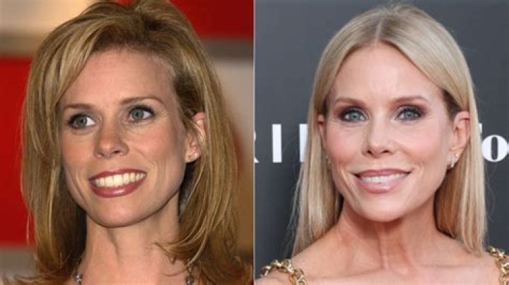 Did Cheryl Burke Get Plastic Surgery? The ‘DWTS’ Pro Has Been Fighting Rumors for Years