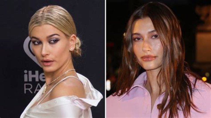 Did Hailey Bieber Ever Get Plastic Surgery? Kanye West Alleges She Got a Nose Job