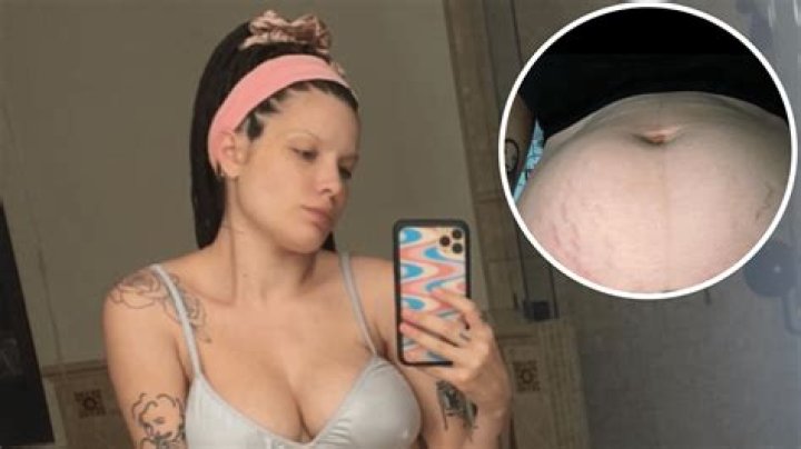 Halsey Shares an ‘Important’ Post About Their ‘Changing’ Postpartum Body: ‘I’m Really Tired’