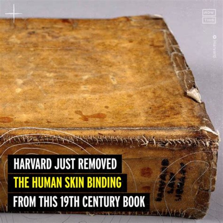 Harvard Removes Book Bound In Human Skin From Library