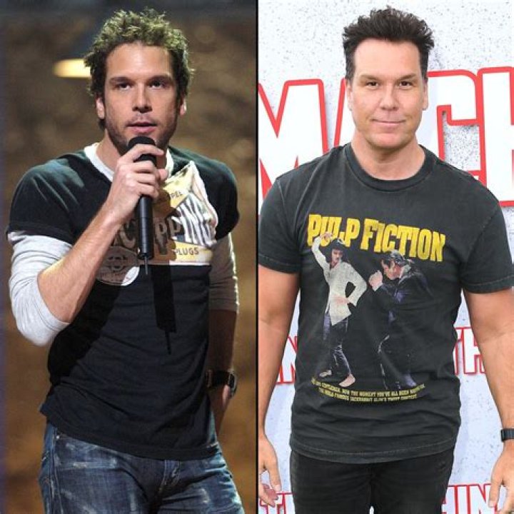 Has Dane Cook Had Plastic Surgery? See His Transformation From Young Comedian to Now