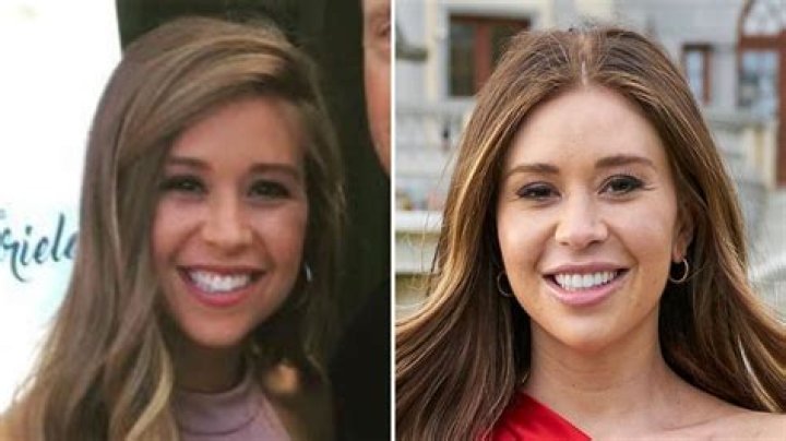 Has ‘The Bachelorette’ Lead Gabby Windey Had Plastic Surgery? See Her Photos Over the Years