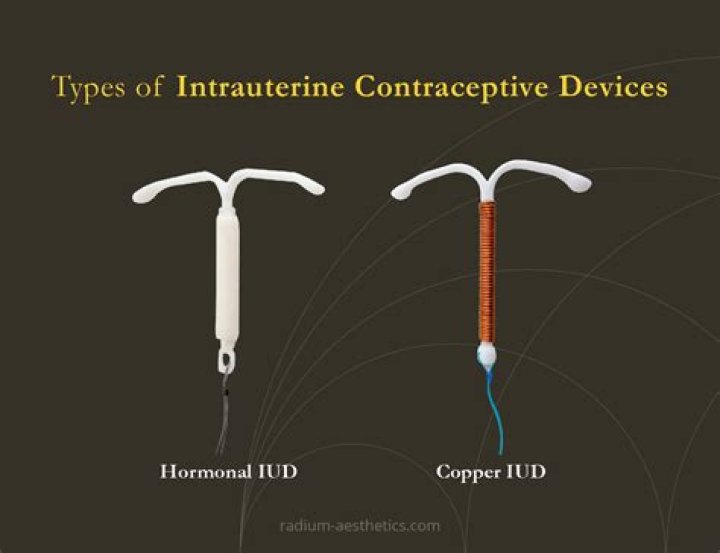 History’s 29 Scariest Contraceptive Devices