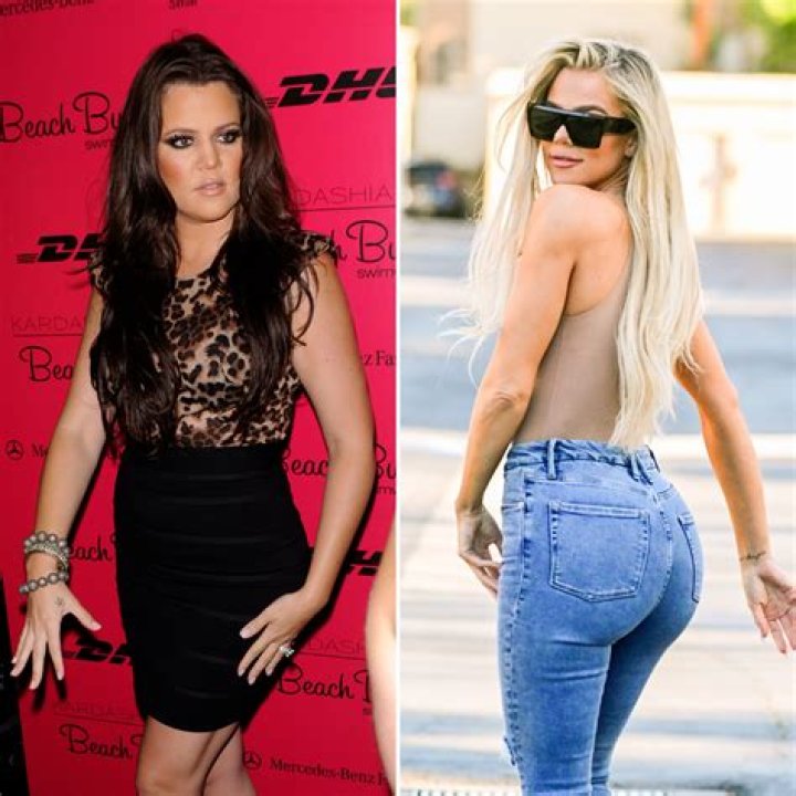 Is Khloe Kardashian’s Butt Real? See Her Booty Transformation Through the Years