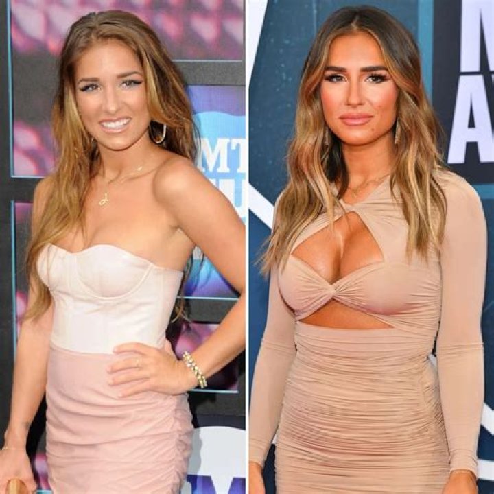 Jessie James Decker’s Plastic Surgery: Why She Got a Breast Enhancement and What Else She’s Had Done