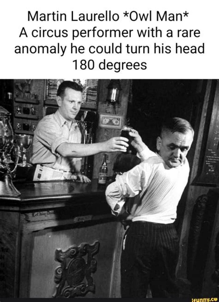 Martin Laurello, The Human Owl Whose Head Turned 180 Degrees