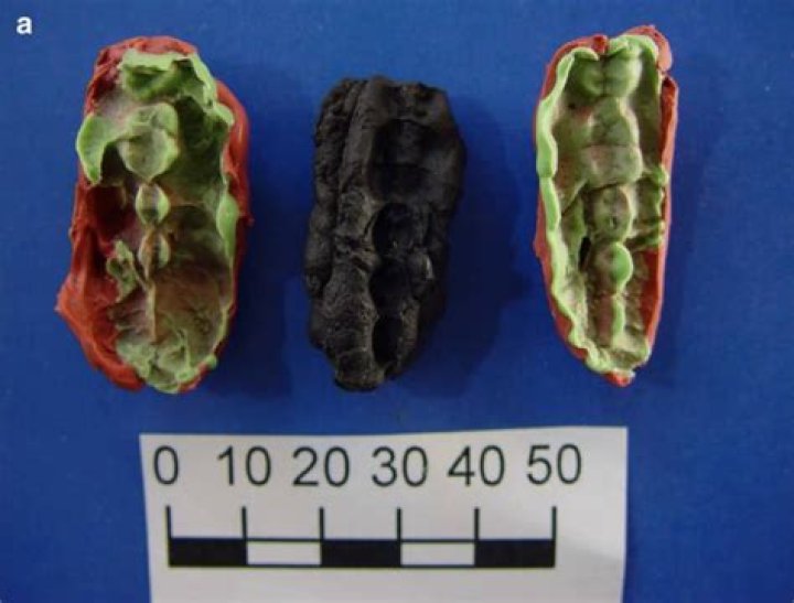 Oldest Scandinavian DNA Found In Ancient Chewing Gum