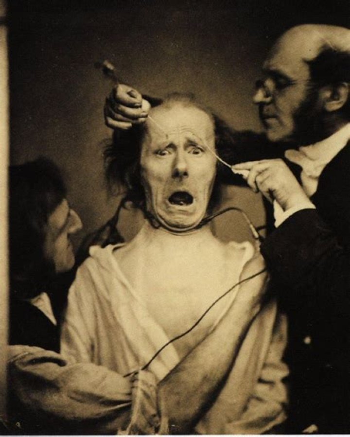 Photos Of Duchenne de Boulogne's Experiments On The Human Face