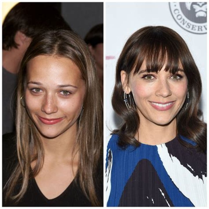 Plastic Surgery Experts Weigh in on Whether Rashida Jones Went Under the Knife!
