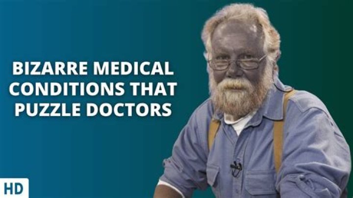 The Five Most Unusual Disorders Suffered By Humans