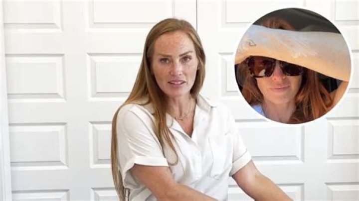 What happened to Mina Starsiak’s eye? Reveals Scary Vision Loss.